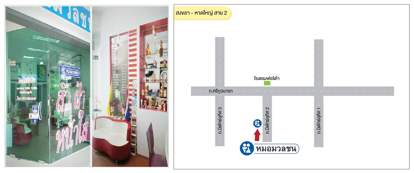 สงขลา - หาดใหญ่ สาย 2