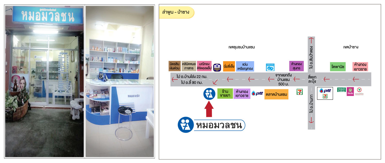 ศูนย์บริการผลิตภัณฑ์หมอมวลชน ลำพูน ป่าซาง