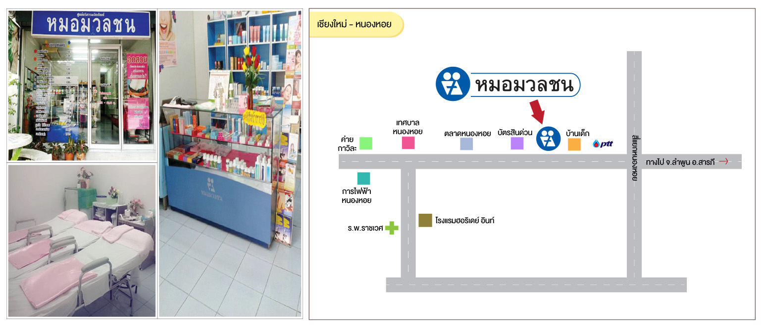 ศูนย์บริการผลิตภัณฑ์หมอมวลชน เชียงใหม่ อ.หนองหอย